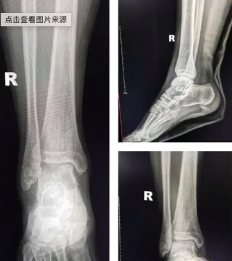 ​  创伤骨科